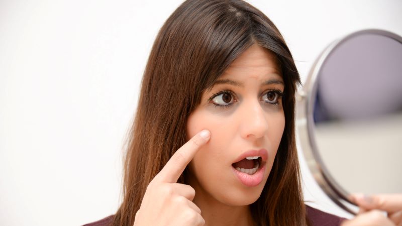 ত্বকের রঙ পরিবর্তন, পেছনে বড় কোন রোগের ইঙ্গিত নয়তো?